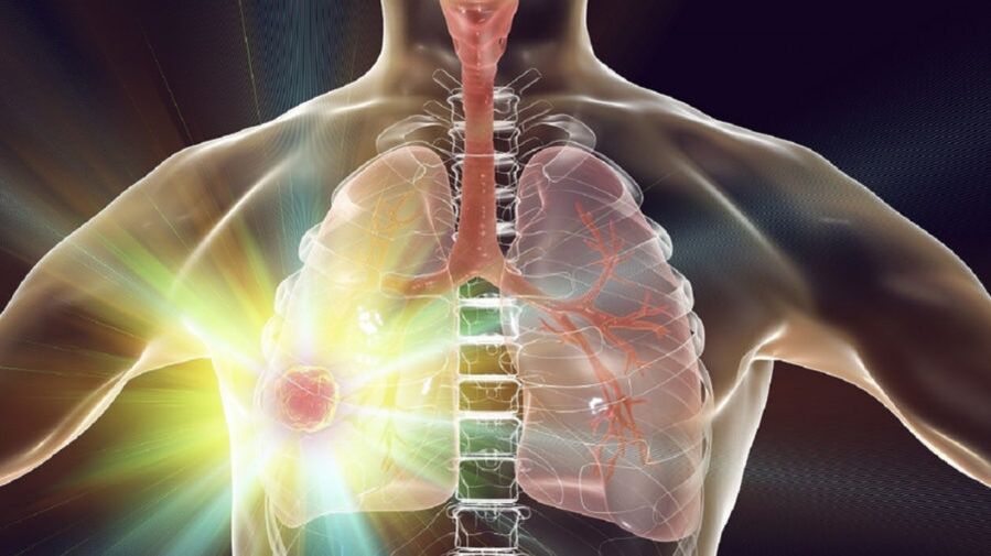 sistemul respirator la renunțarea la fumat