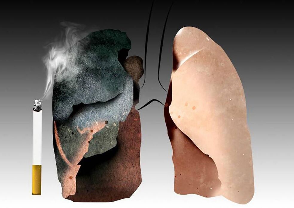 plămânii unui fumător
